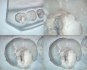 Surgical microscope Leica M520 - neurosurgery, cardiac surgery, spine surgery - foto 22
