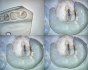 Surgical microscope Leica M525 F40 - neurosurgery, cardiac surgery, spine surgery - foto 22