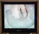 Хирургический микроскоп Zeiss OPMI Sensera S7 со встроенной видеосистемой Carl Zeiss - foto 19
