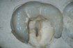 Хирургический микроскоп для стоматологии Zeiss OPMI 11 S21 - foto 12